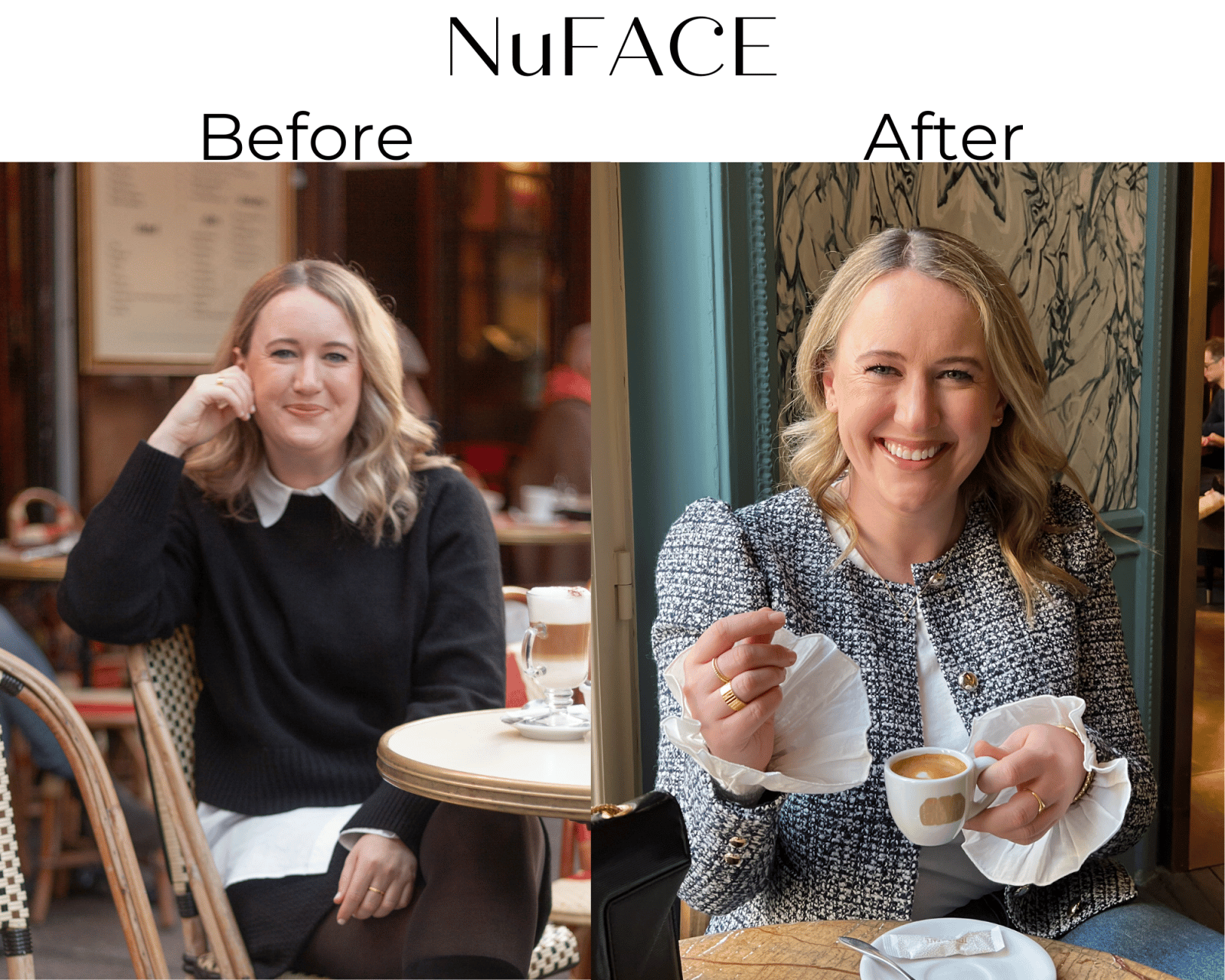 nuFace before and after
